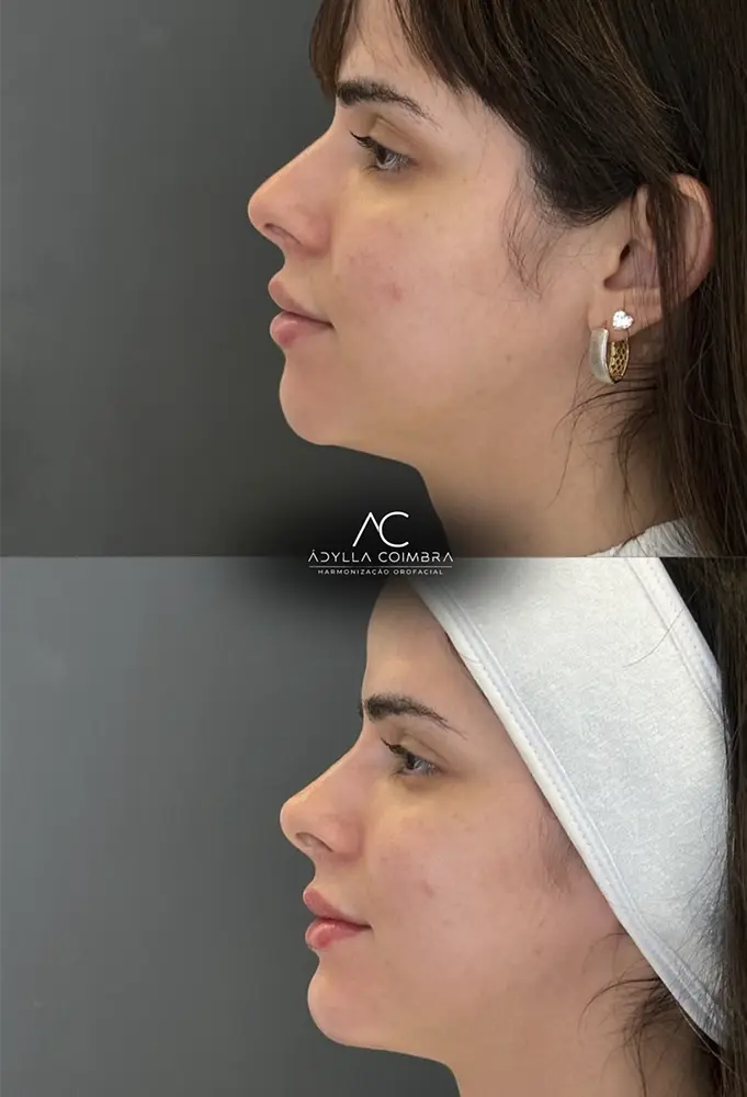 harmonizacao-porto-velho-ro-adyllacoimbra