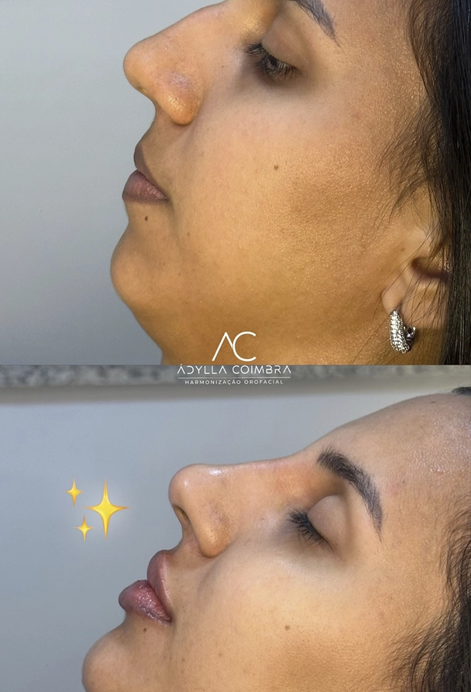 harmonizacao-portovelho-adylla-coimbra-2