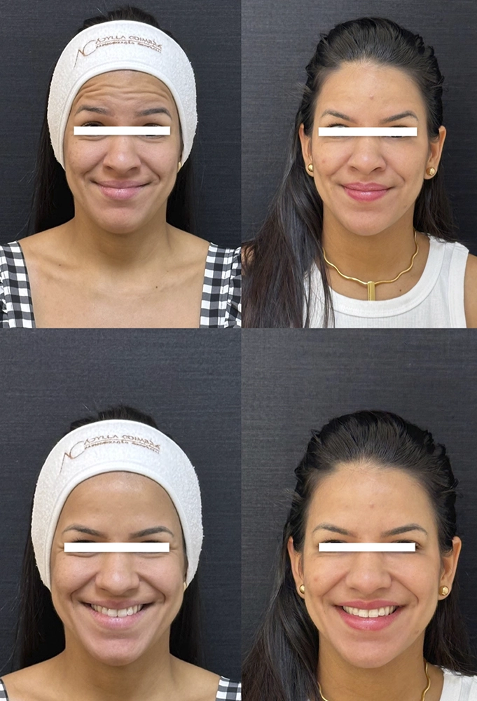 harmonizacao-portovelho-adylla-coimbra-3