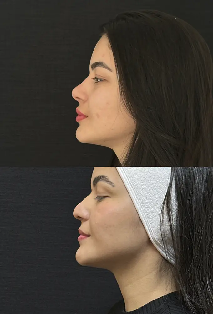 harmonizacao-porto-velho-ro-adylla-rosto